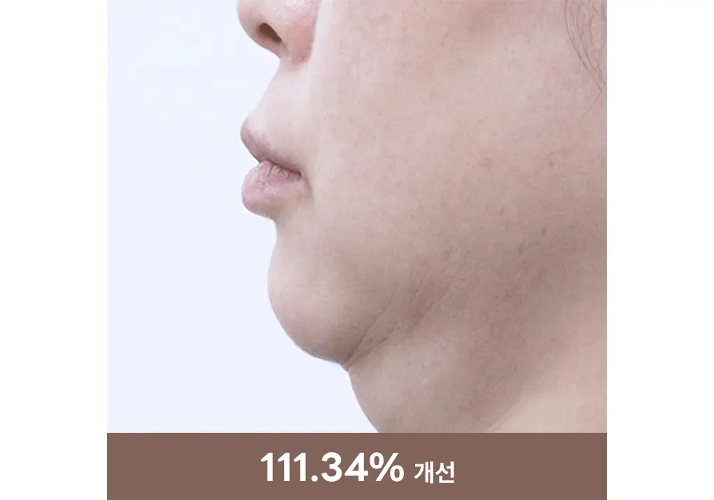 [탄력리프팅/4매] 메디힐 레티놀 콜라겐 윤곽 마스크 2종 (앰플/크림) 상세페이지 17
